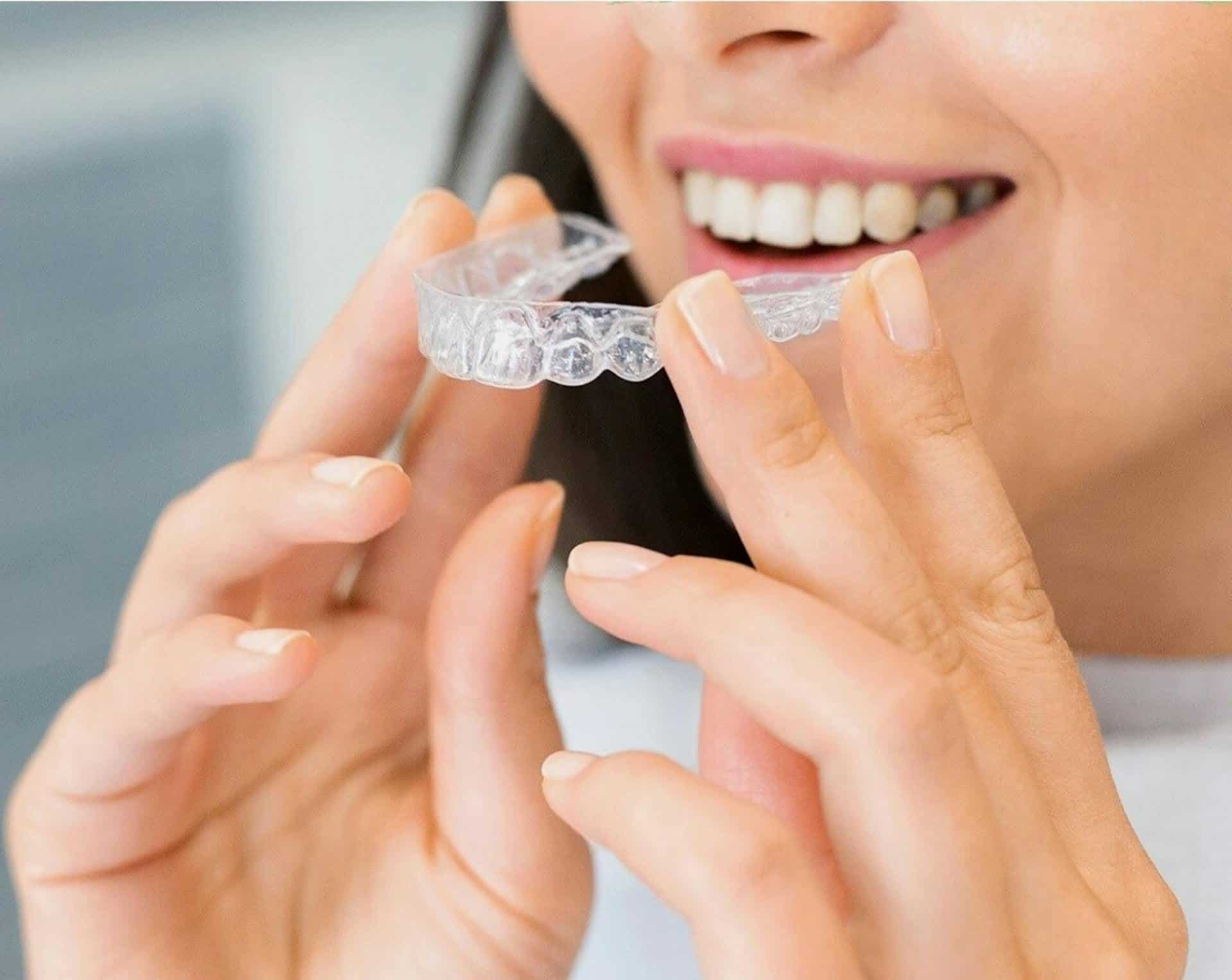 Teeth Aligners Dwarka 6 invisible teeth aligners