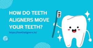 How Do Teeth Aligners Move Your Teeth?