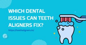 Which Dental Issues Can Teeth Aligners Fix?
