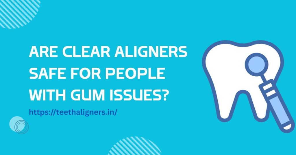 Clear Aligners