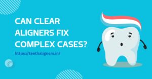 Clear Aligners
