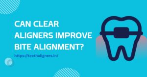 Clear Aligners