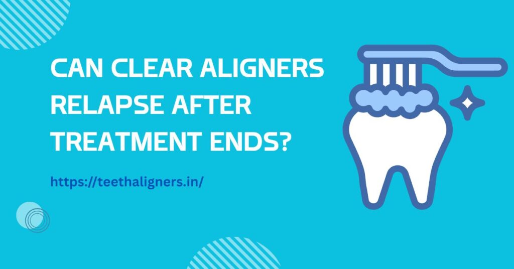 Clear Aligners