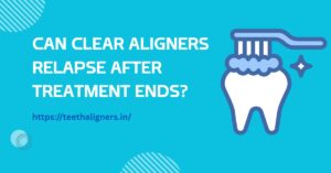 Clear Aligners