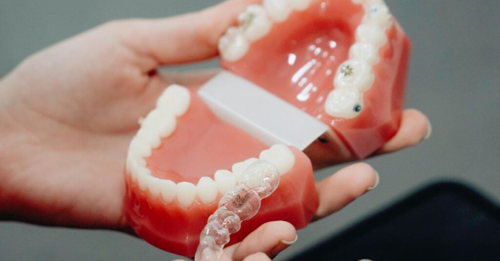 Can Clear Aligners Relapse After Treatment Ends? 1 Clear Aligners 7