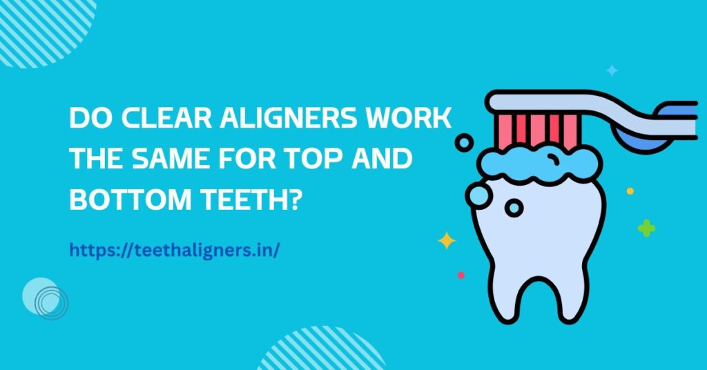 Clear Aligners