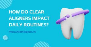 Clear Aligners