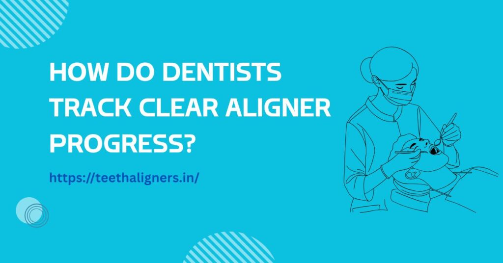 Clear Aligner