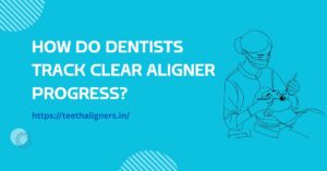 Clear Aligner