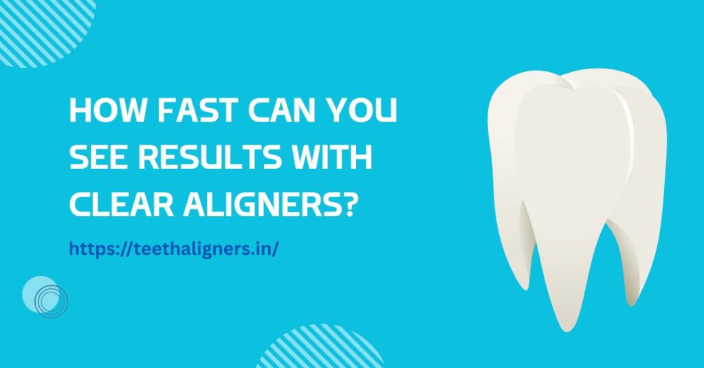 Clear Aligners