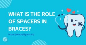 Home 4 What Is the Role of Spacers in Braces