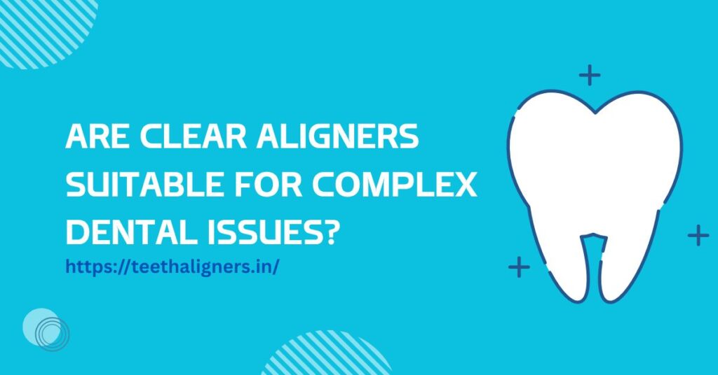 Clear Aligners