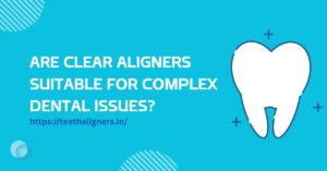 Clear Aligners