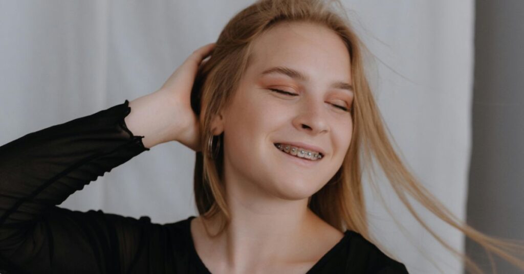 Can Adults Benefit from Braces Too? 1 Braces 15