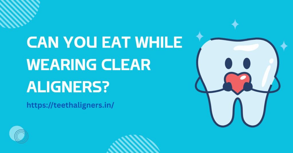 Clear Aligners