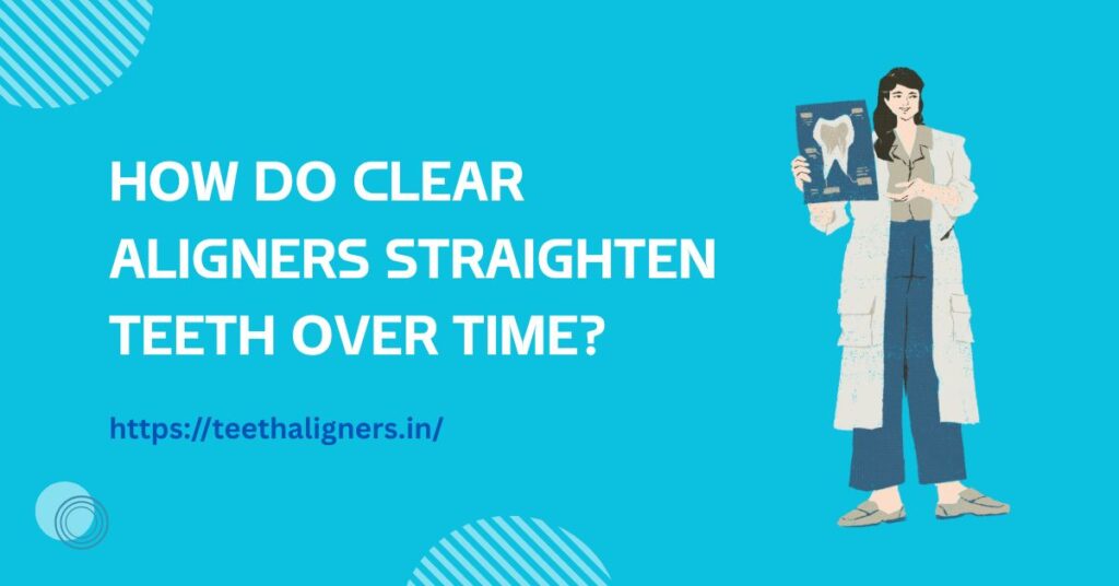 Clear Aligners