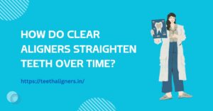 Clear Aligners