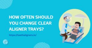 Clear Aligners