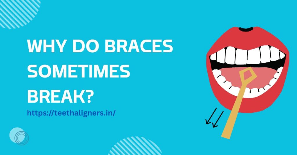 Braces