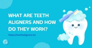 Teeth Aligners