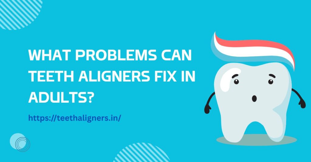 Teeth Aligners