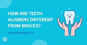 Teeth Aligners